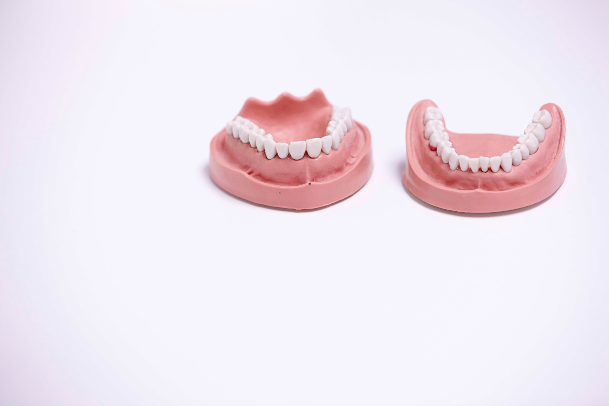 Zahnmodelle von Ober- und Unterkiefer für die Seniorenzahnheilkunde